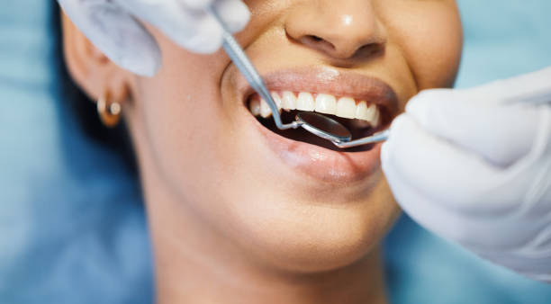 Tooth Infection Emergency Dentist in MI